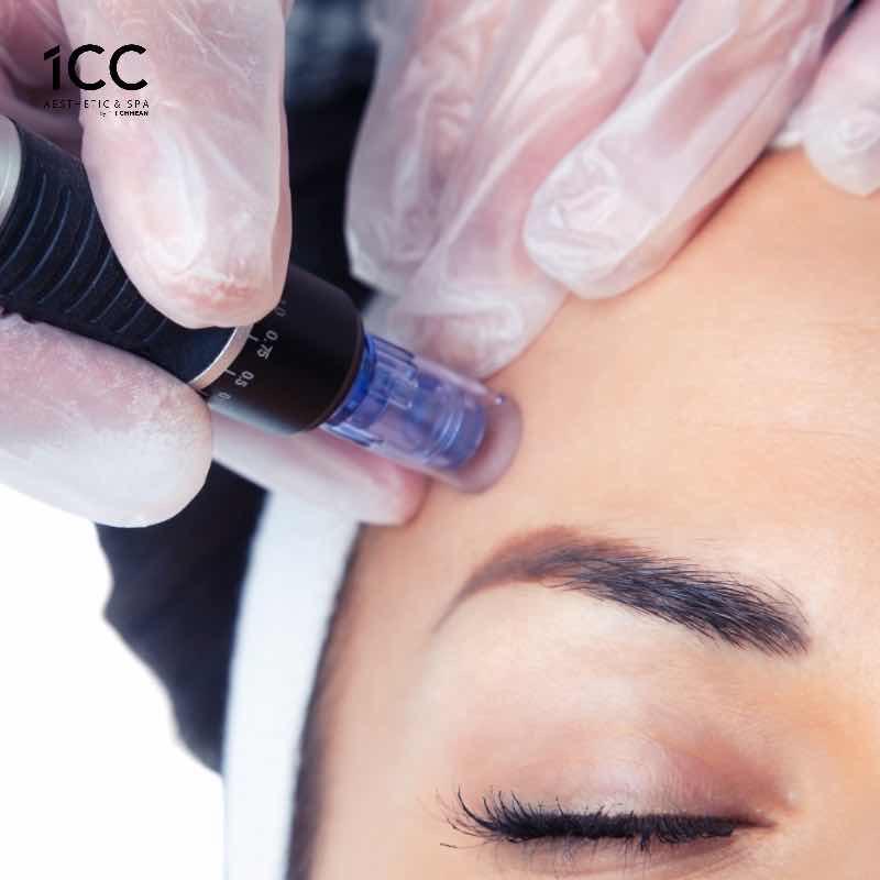 ដើរម្ជុលទាល/Nano peeling Bright