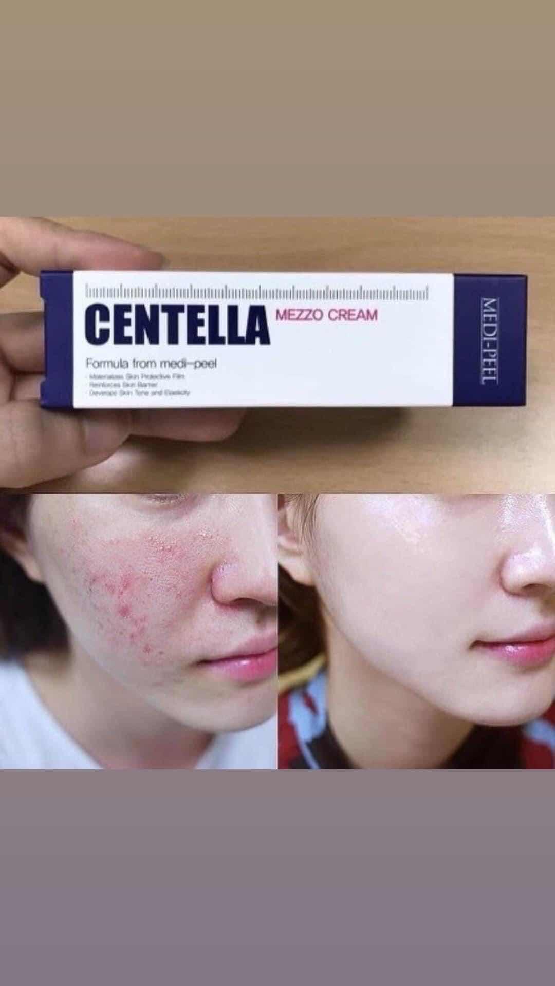 Medipeel cream មុន