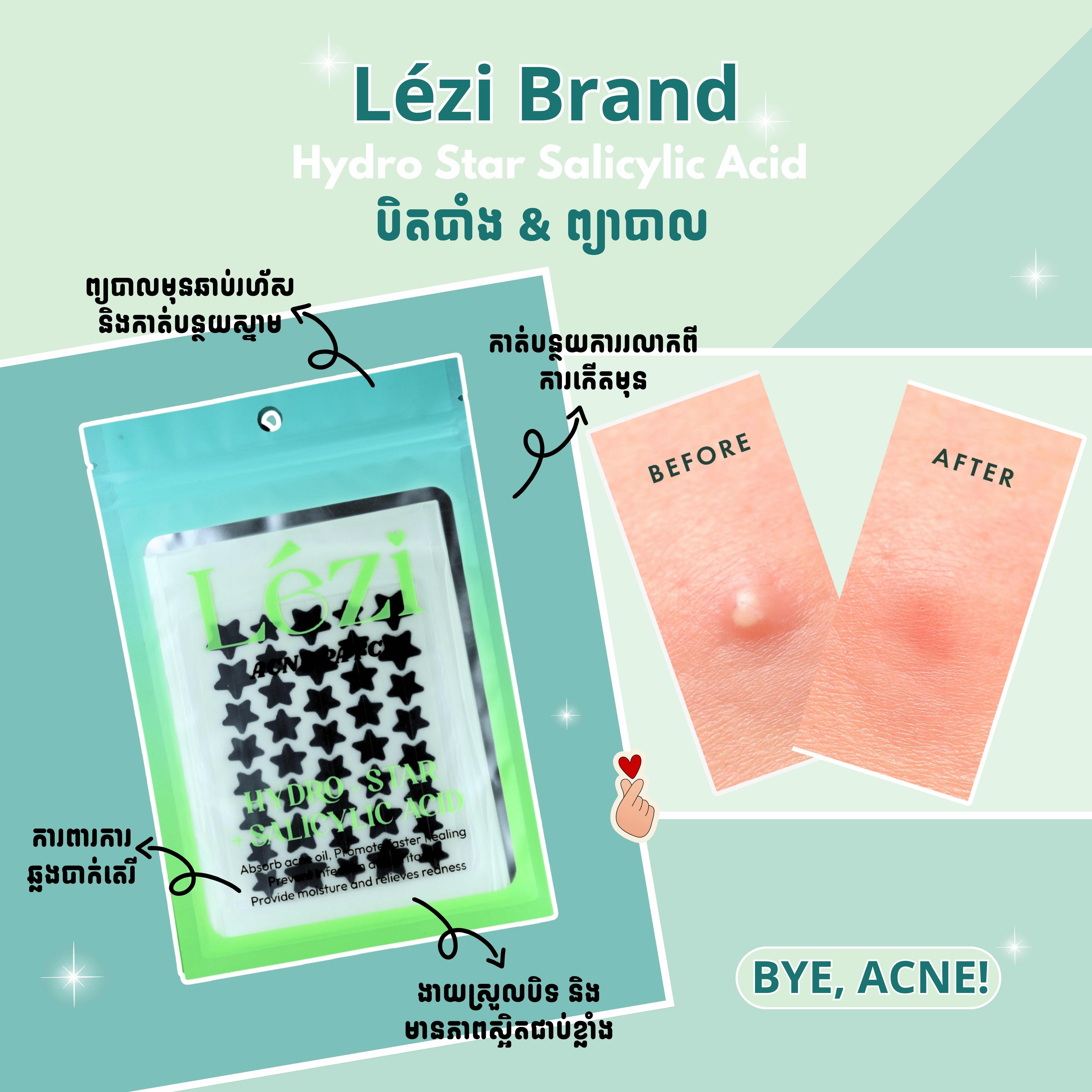 Lézi Pimple Patches Big 