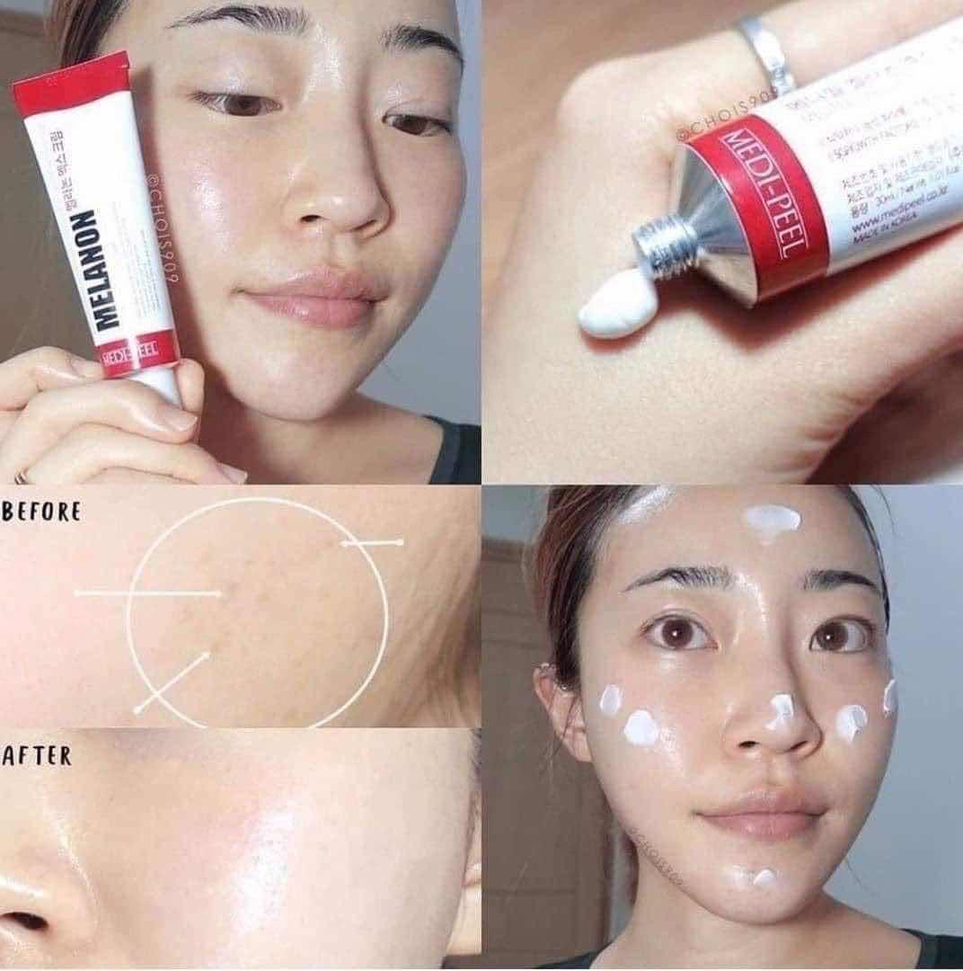 Medipeel cream ជាំ