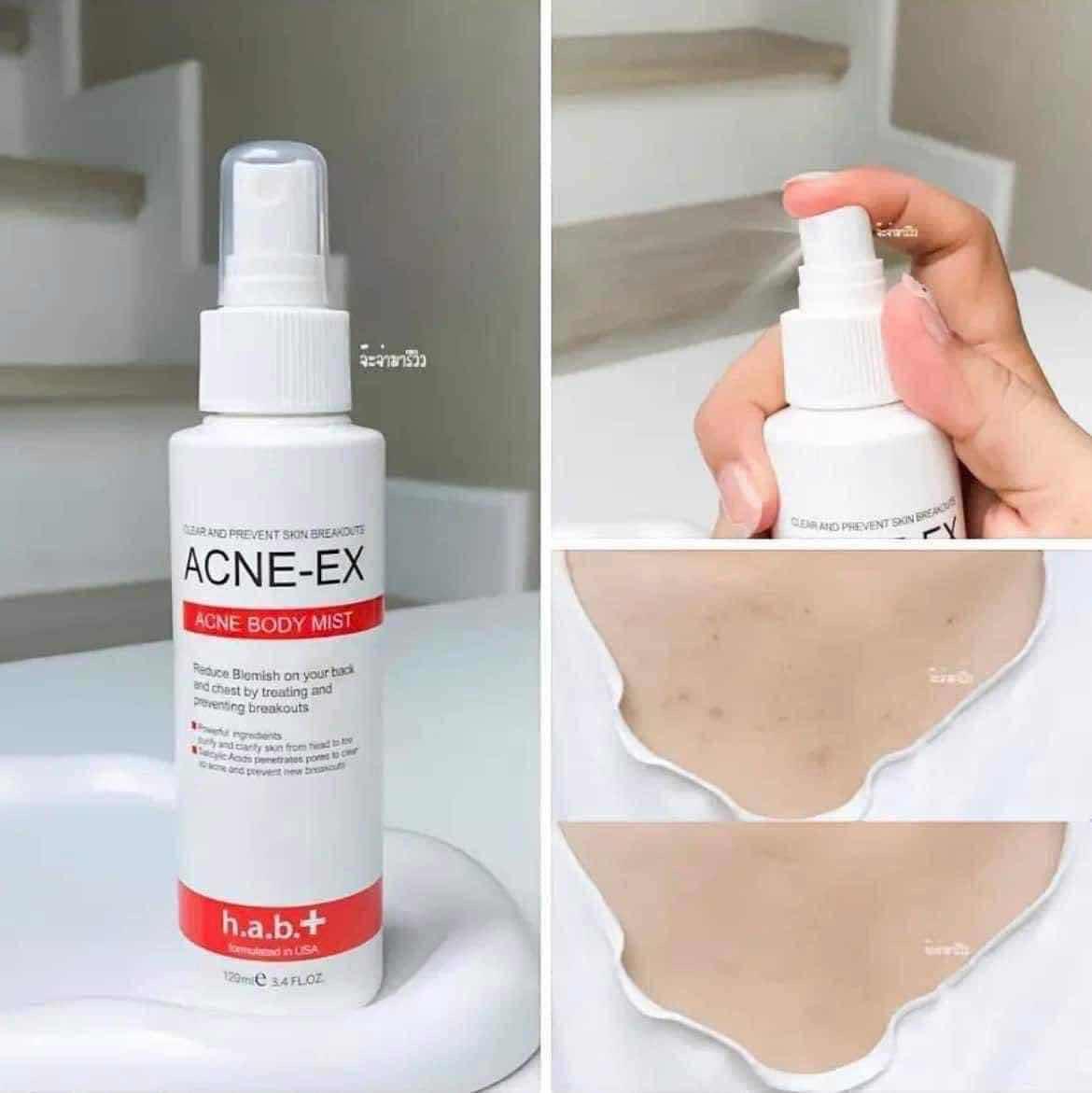Acne Ex Body Mist - Back Spray 