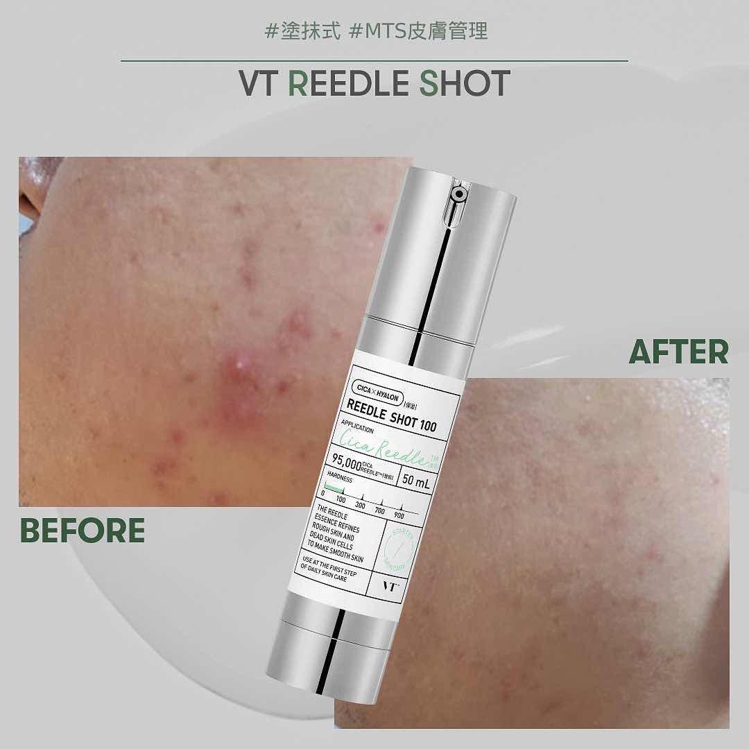VT Reedle Shot 100
