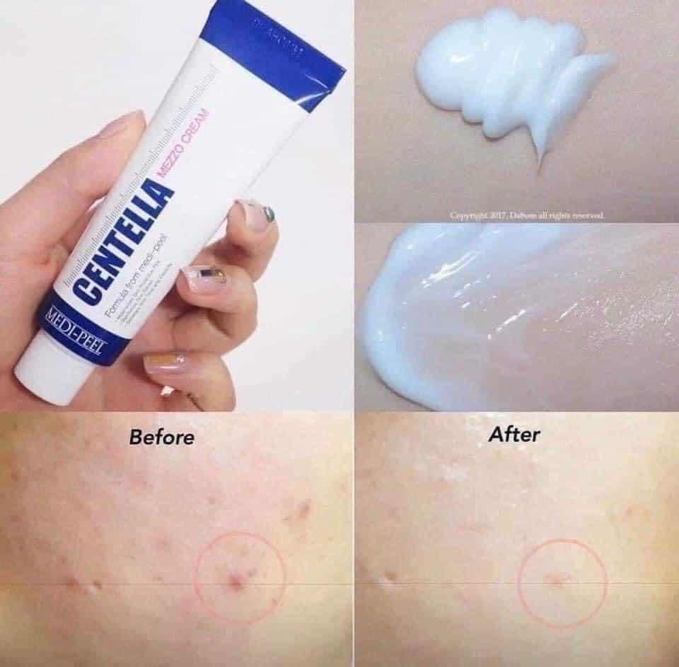 Medipeel cream មុន