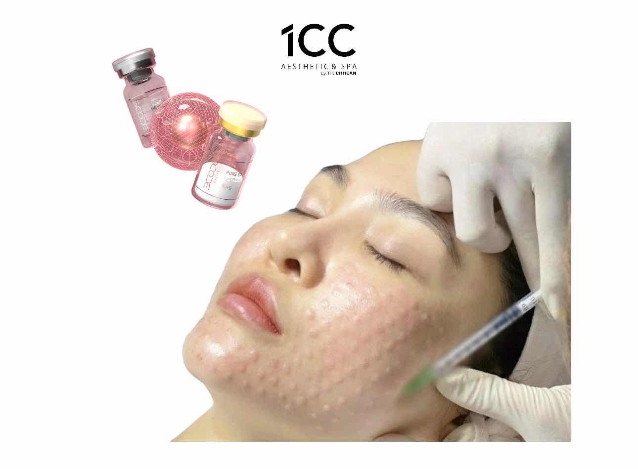 ចាក់មុខក្មេងជាងវ័យ / EXOXE treatmant