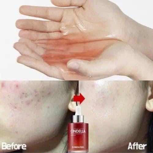 Medipeel cream មុន