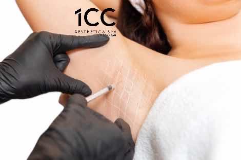 ចាក់បំបាត់ក្លិនក្លៀក/ Botox armpit
