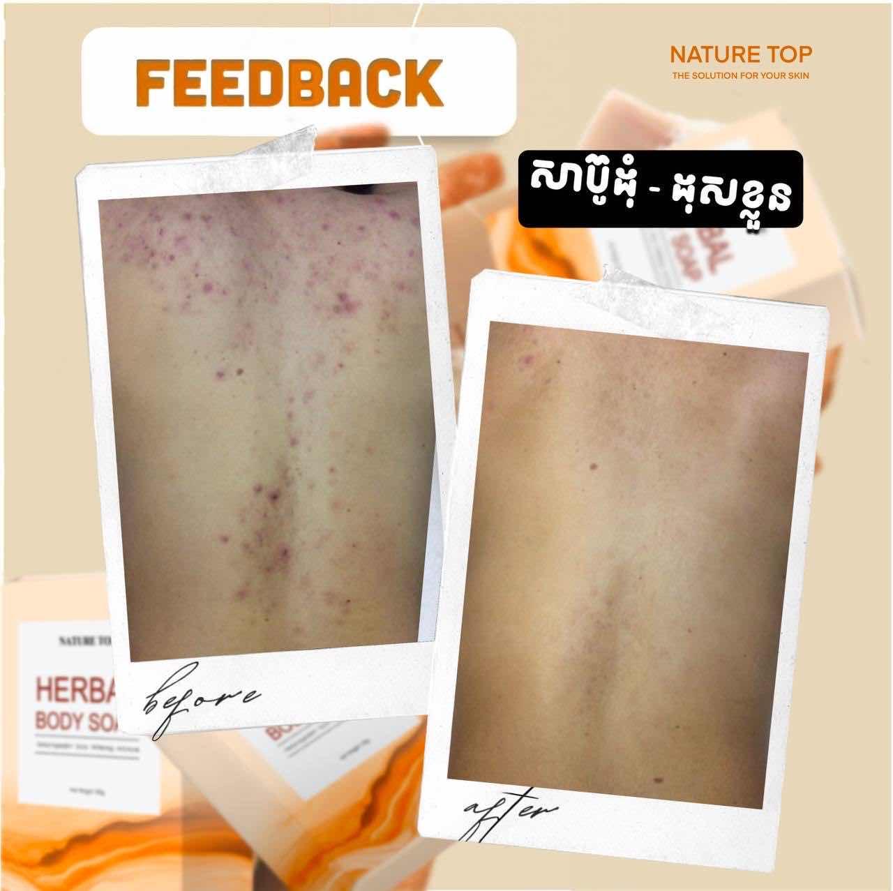 HERBAL BODY SOAP