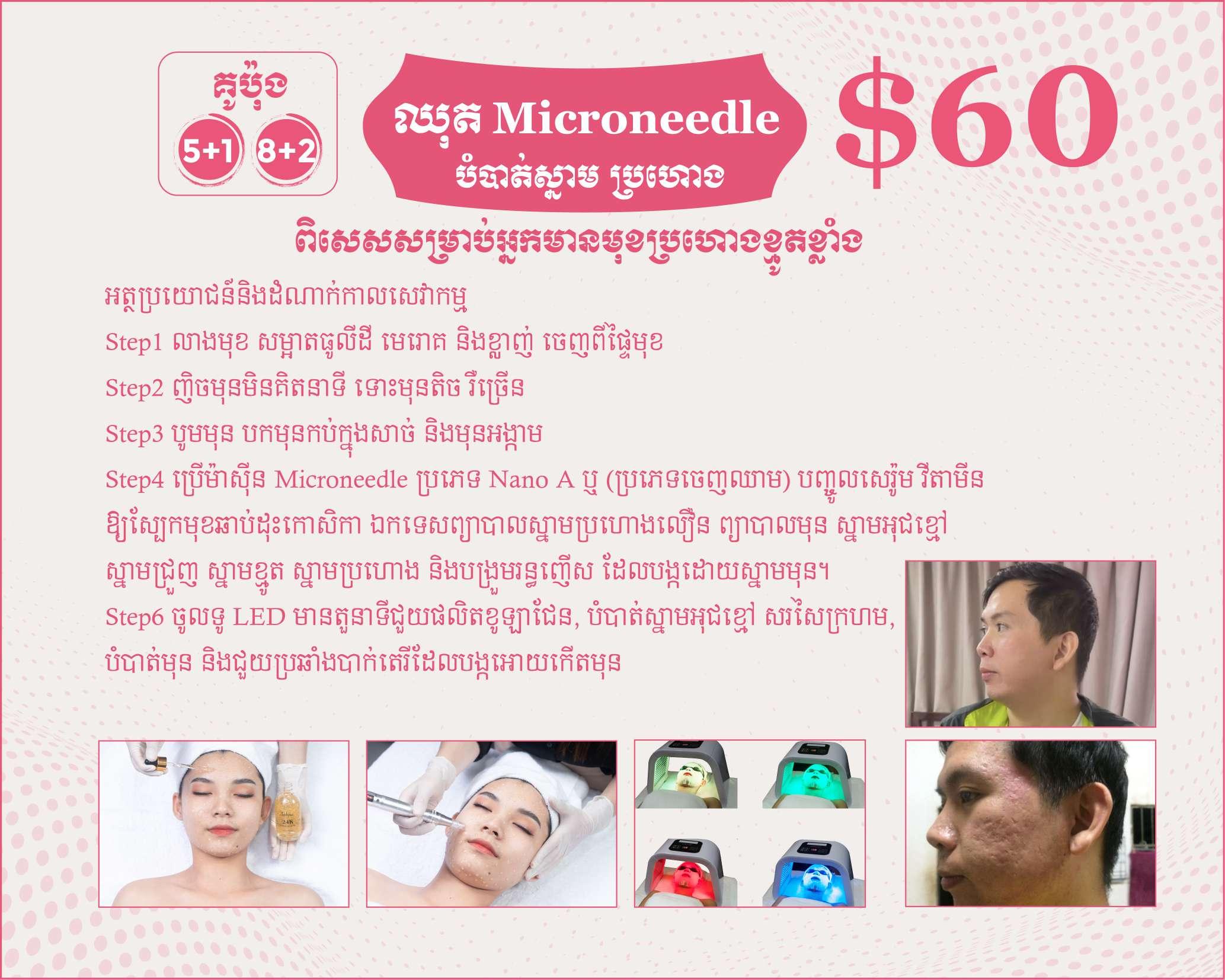 ឈុត Microneedle បំបាត់ស្នាមប្រហោង ខ្មូត